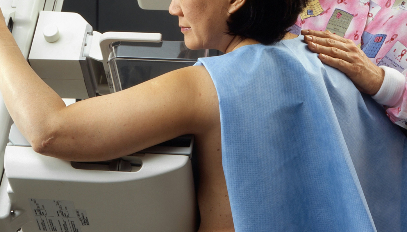 Inteligência artificial pode melhorar diagnóstico de câncer de mama: ferramenta já prevê doença anos antes