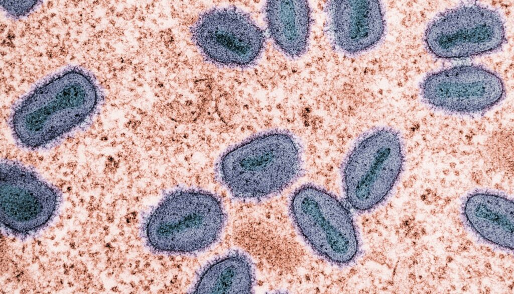 mpox