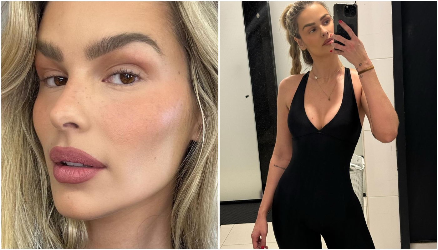 Yasmin Brunet mostra antes e depois do corpo com tratamento de lipedema: “Muita diferença”