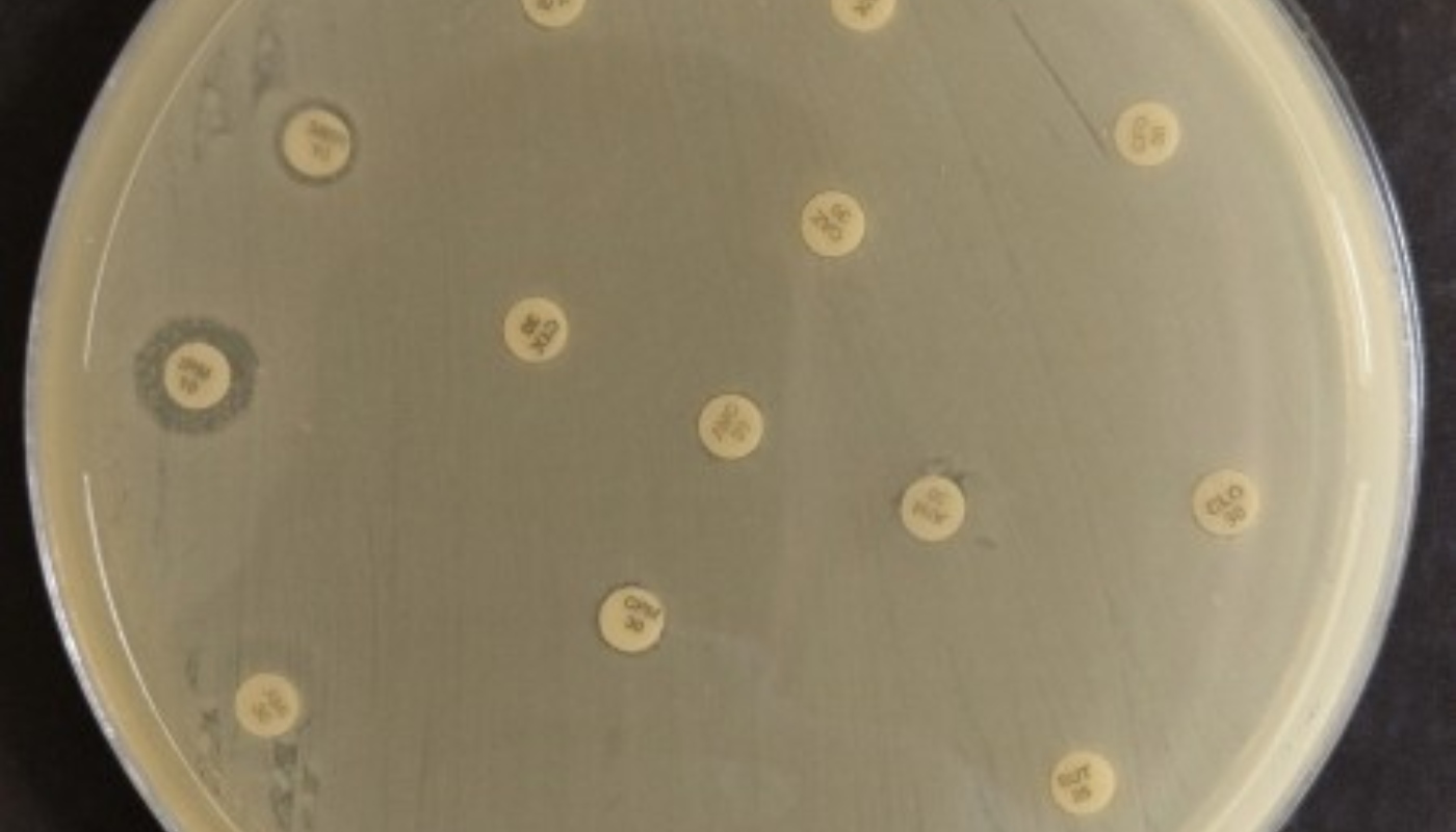 Bactéria resistente que representa risco global é identificada por cientistas no Nordeste