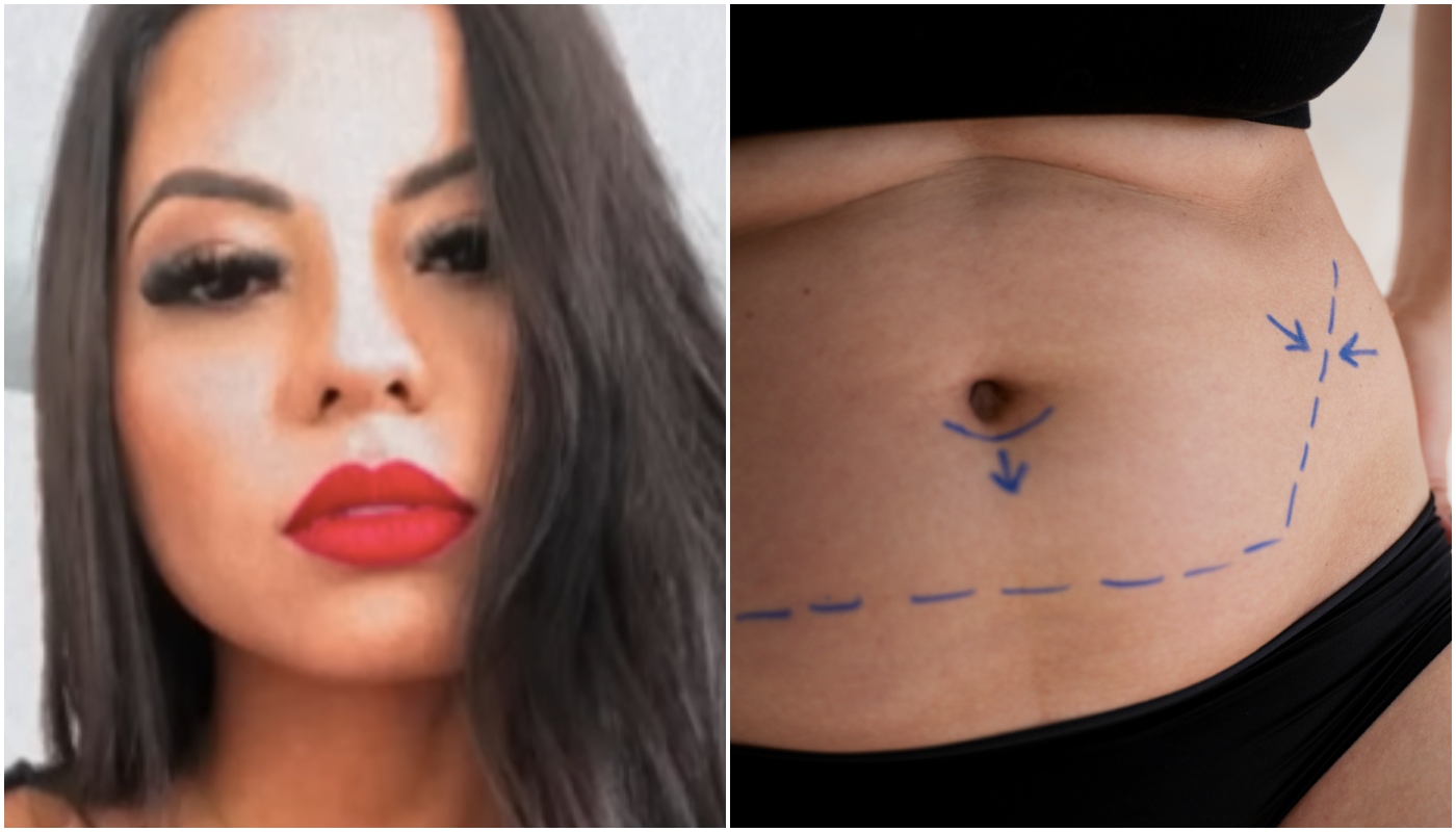 hidrolipo