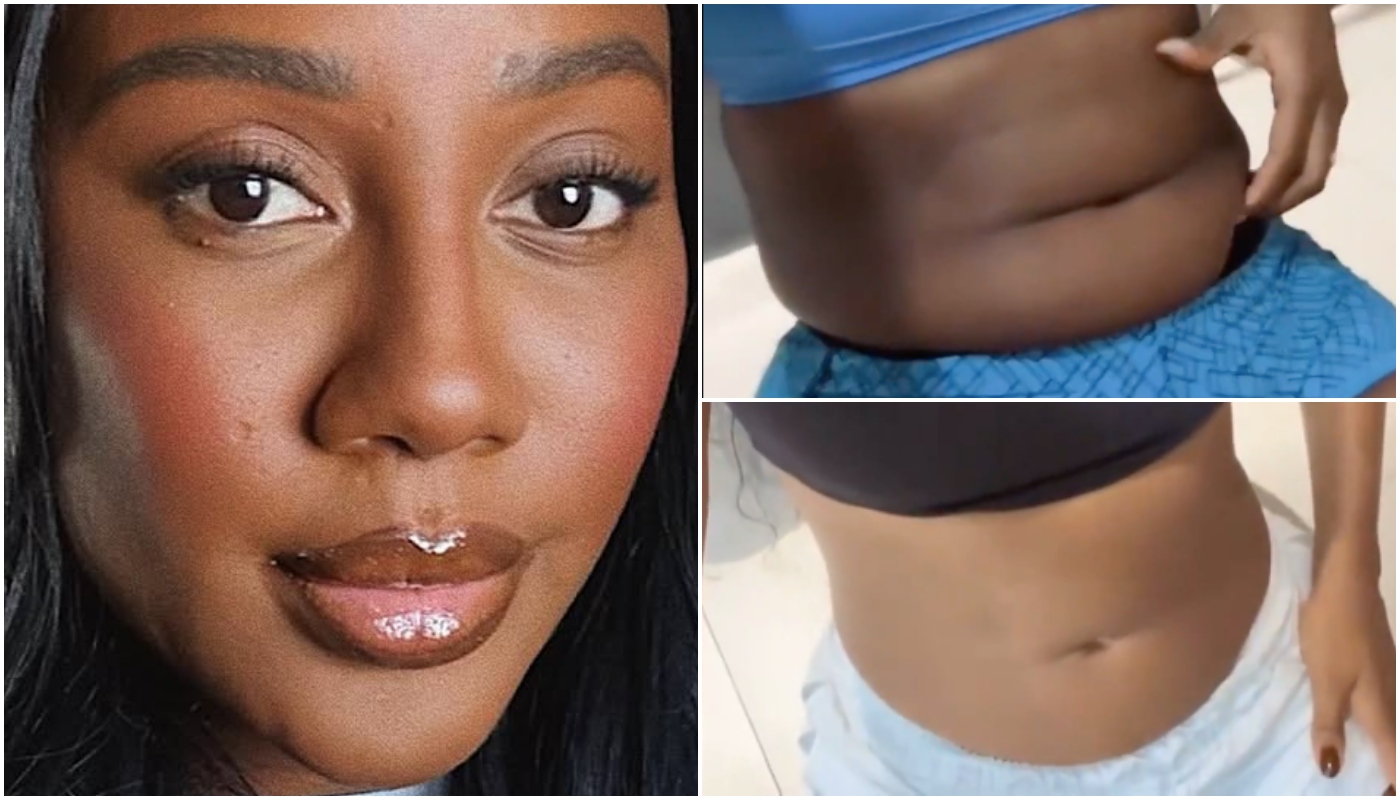 antes e depois de Camilla de Lucas