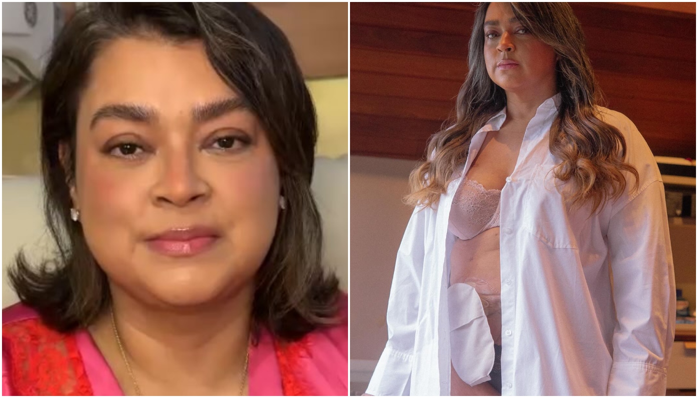 Preta Gil na época em que fez a primeira ostomia (Crédito: Reprodução/Instagram @pretagil)