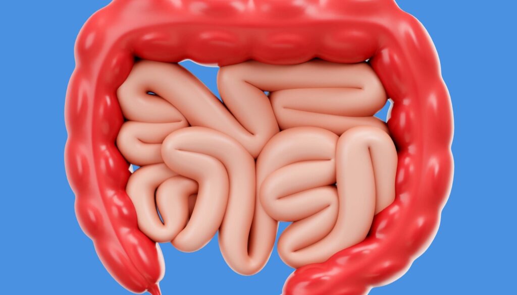 câncer de intestino