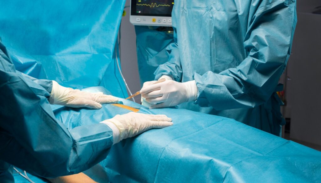 transplante de órgãos
