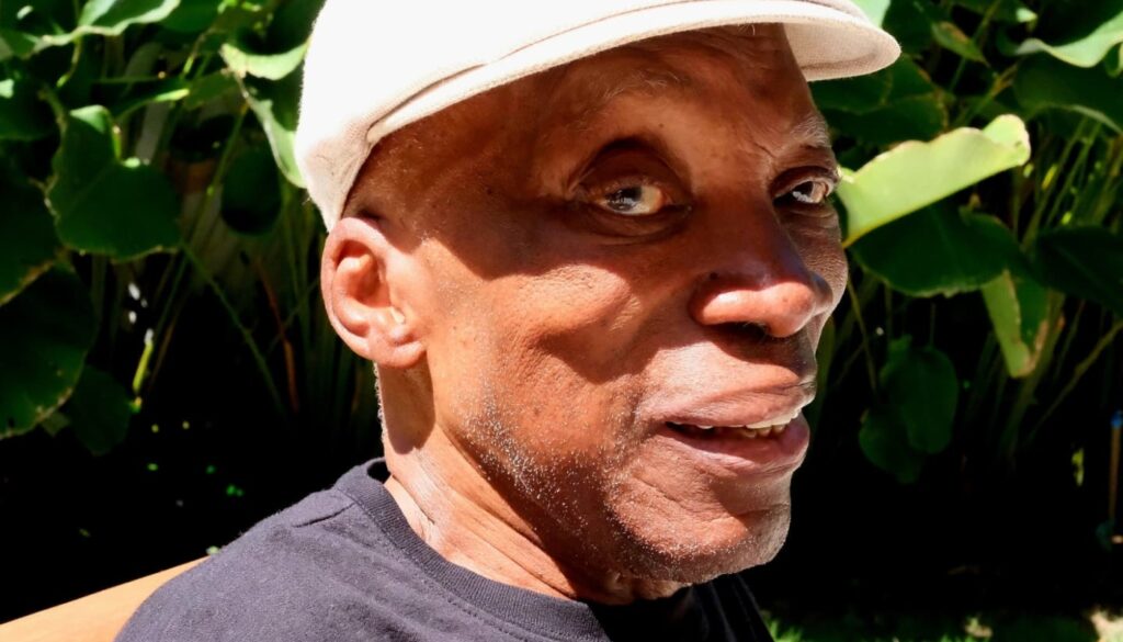 doença de milton nascimento