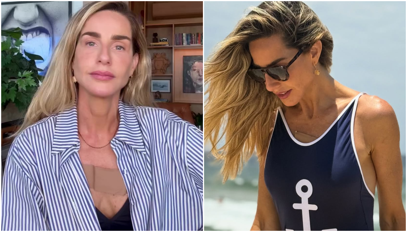 O que é o carcinoma basocelular, câncer de pele de Mariana Weickert?