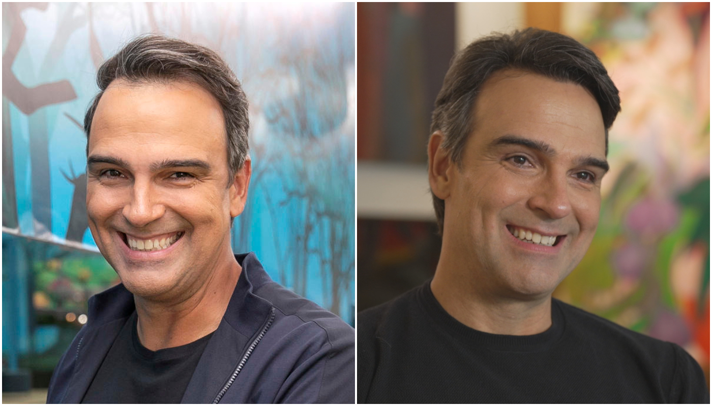 Tadeu Schmidt fez transplante capilar?