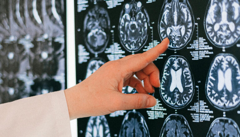 Exames cérebros