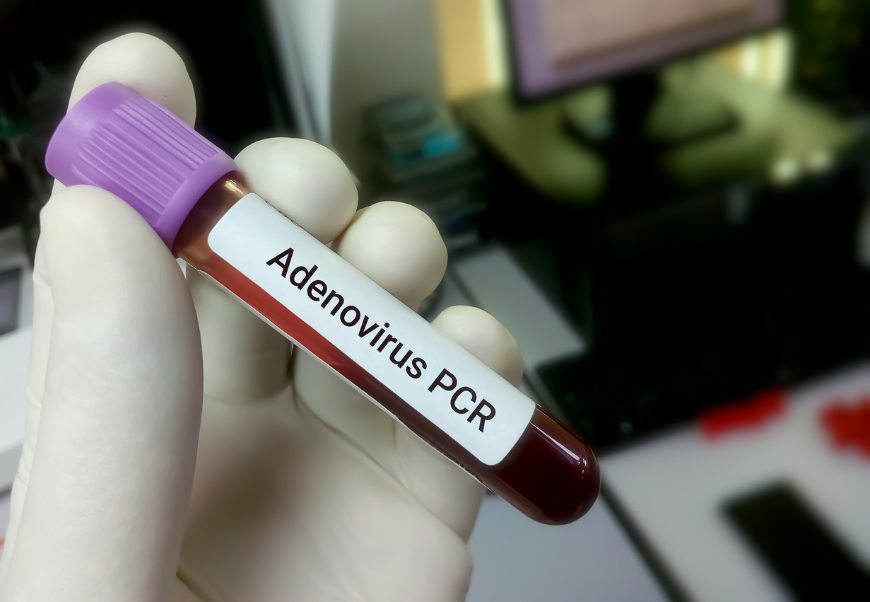 Exame de identificação do adenovírus