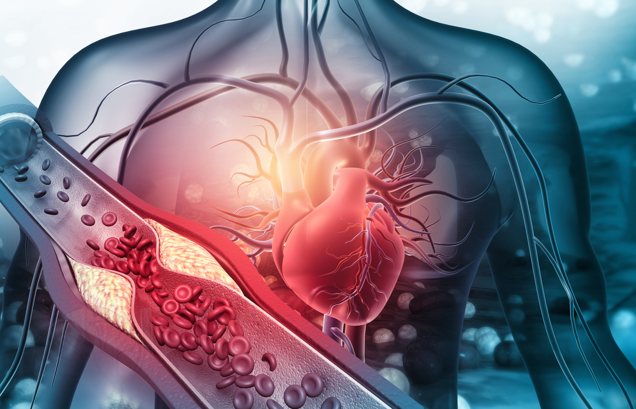 Exame pode ajudar a prevenir doenças cardiovasculares.