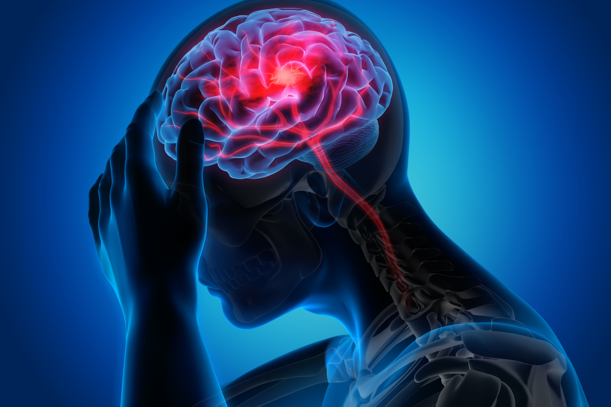 Conheça os sinais de alerta de um derrame cerebral.