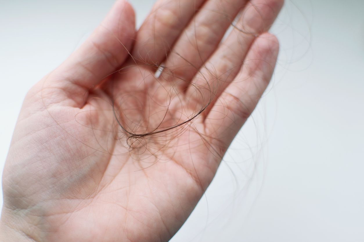 A tricotilomania é mais comum em mulheres adultas do que homens