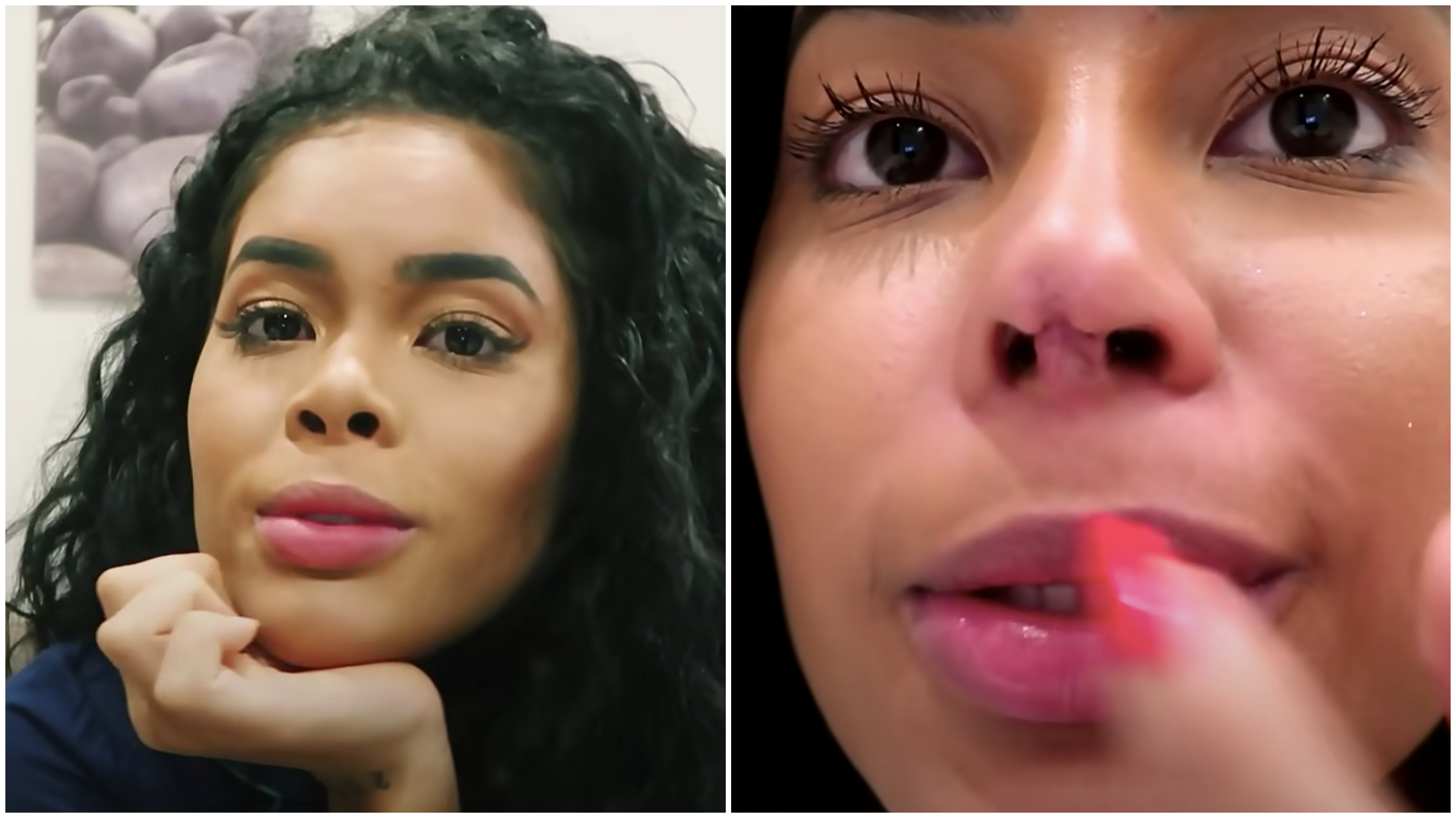 Sthefane Matos fez uma série de cirurgias no nariz e, em uma, teve complicações graves