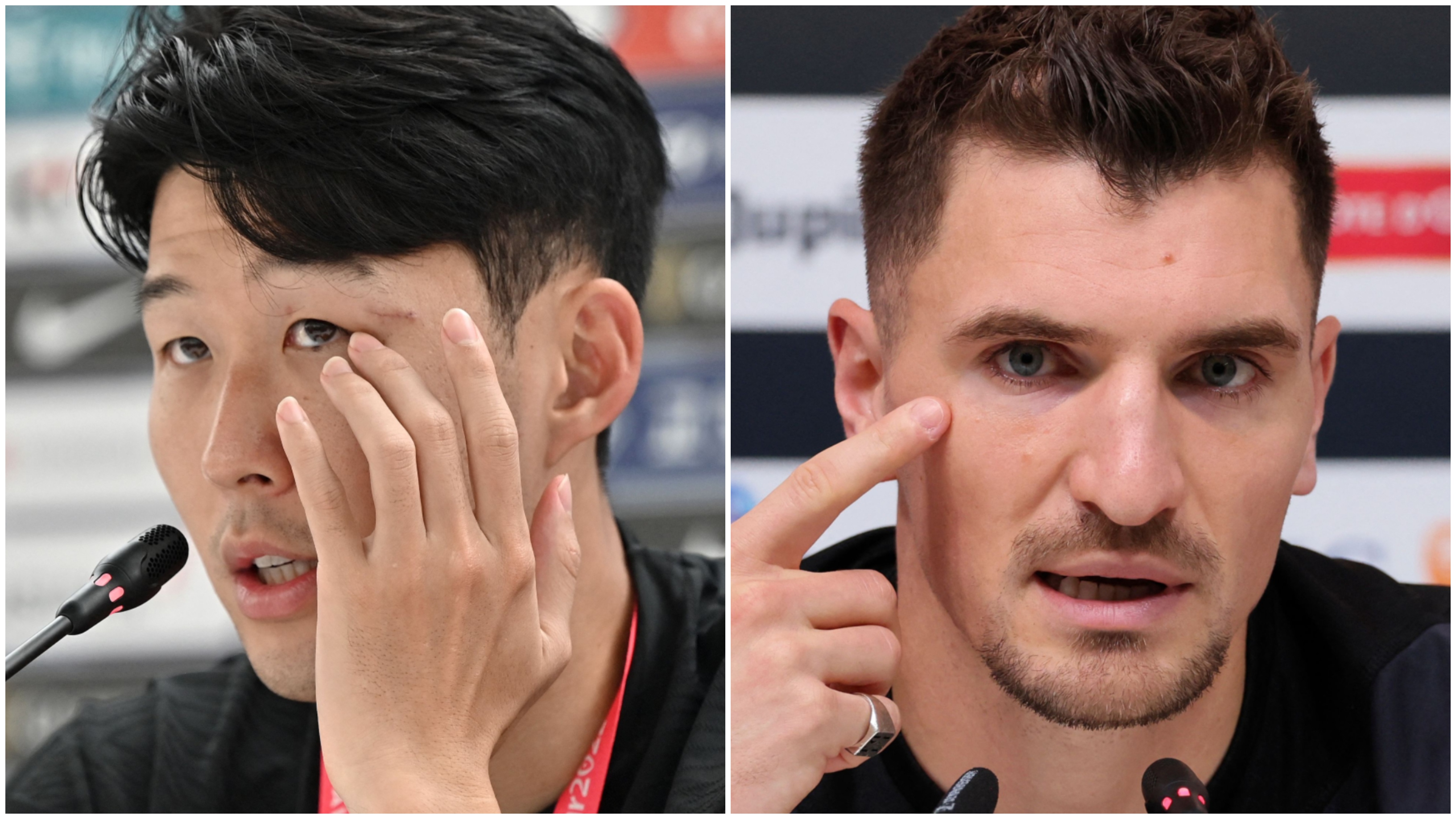 Tanto Son quanto Meunier tiveram lesões no rosto nos últimos meses antes da Copa