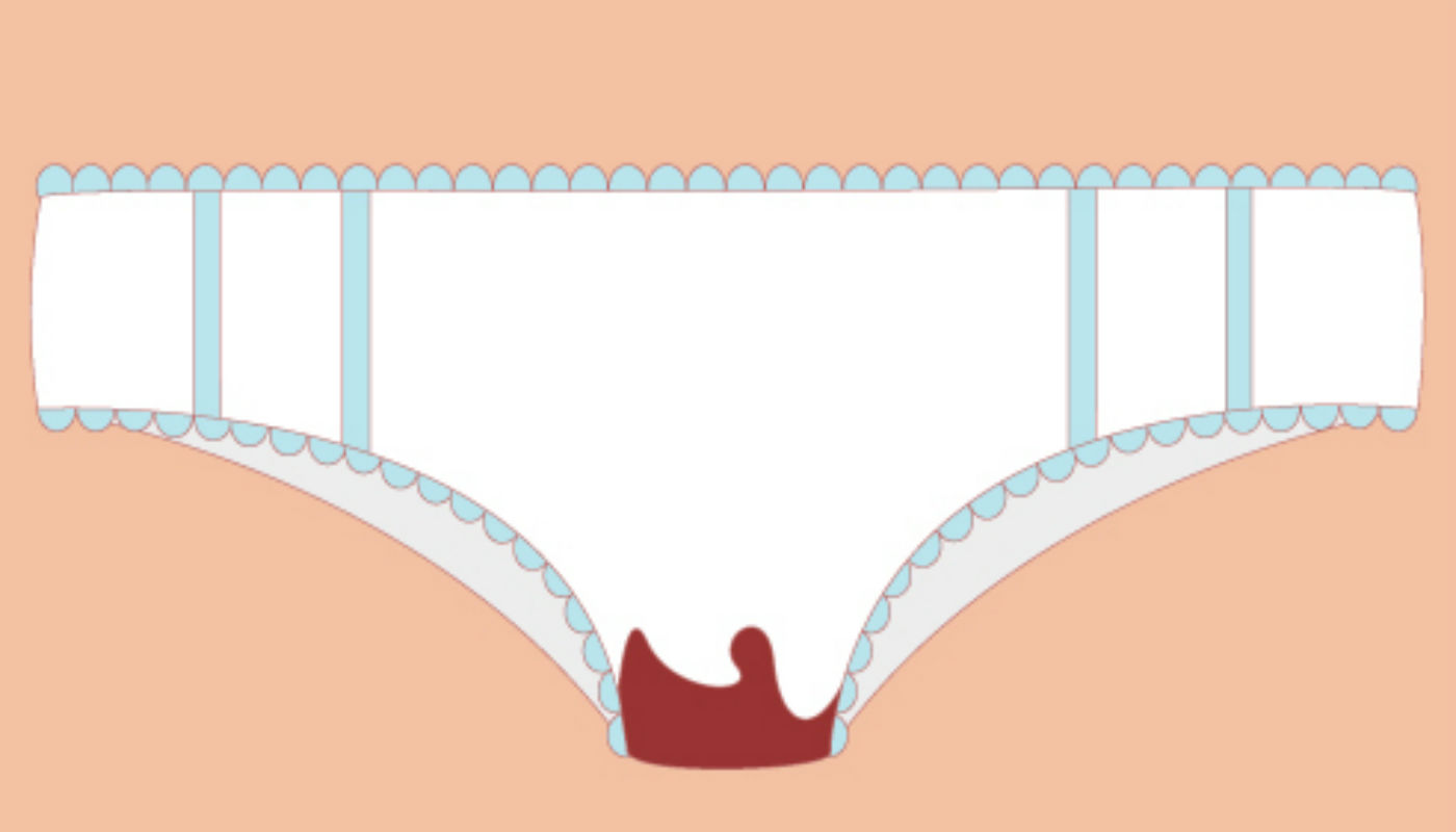 Menstruação com cheiro ruim pode ser aviso do seu corpo sobre 4 problemas