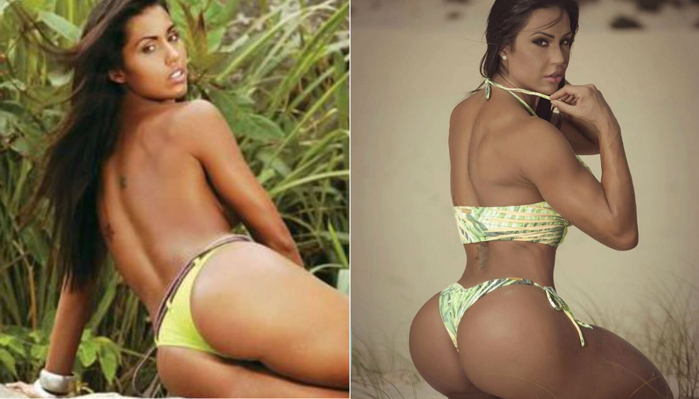 Bumbum na nuca é possível? Os exercícios, alimentos e melhores dicas para conquistá-lo