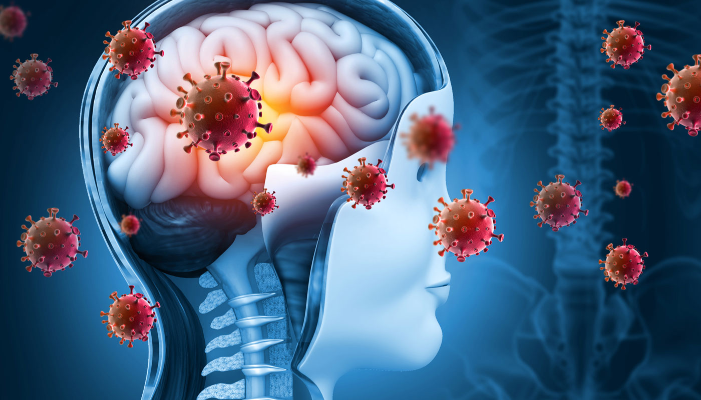 Meningite