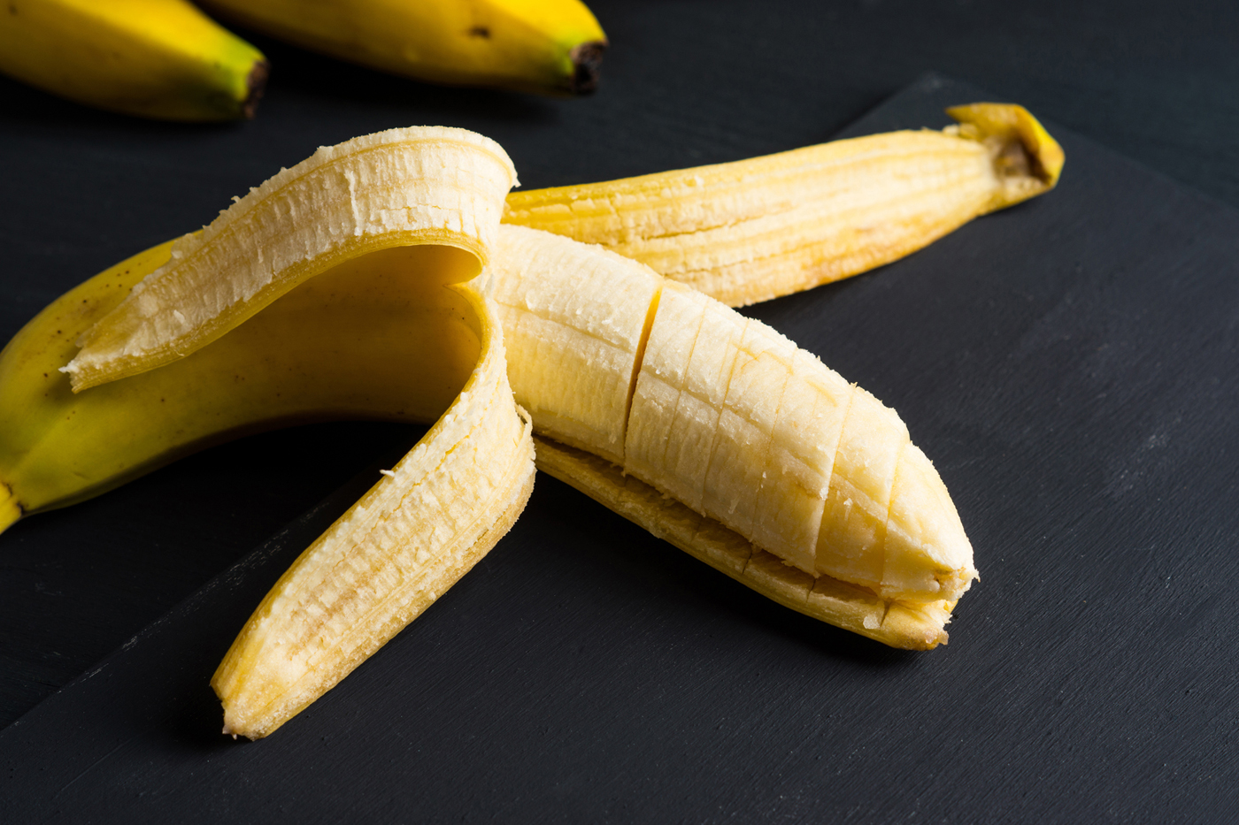 Nutróloga indica comer banana quando casca estiver com muitos pontinhos pretos